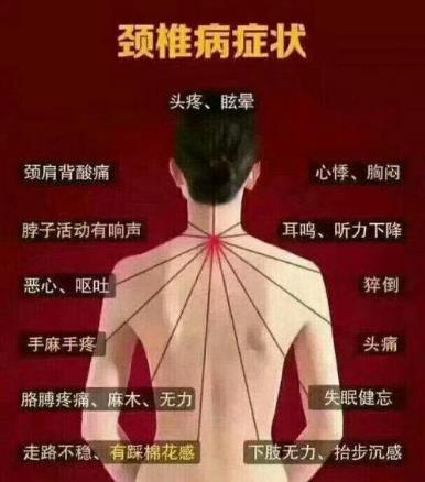 不良习惯让颈椎提前老化 颈椎病的症状及防治 慢性颈椎损伤怎么防